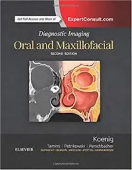 Imagem de Diagnostic Imaging: Oral and Maxillofacial