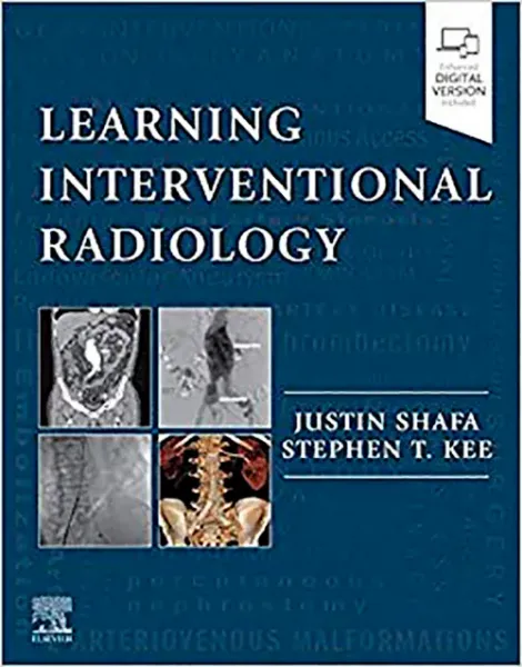 Imagem de Learning Interventional Radiology