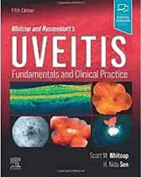 Imagem de Whitcup and Nussenblatt's Uveitis: Fundamentals and Clinical Practice
