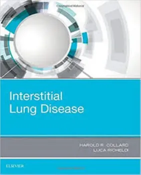 Imagem de Interstitial Lung Disease