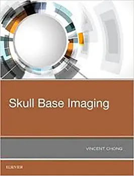 Picture of Book Skull Base Imaging