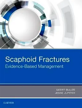 Imagem de Scaphoid Fractures