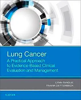 Imagem de Lung Cancer: A Practical Approach to Evidence-Based Clinical Evaluation and Management