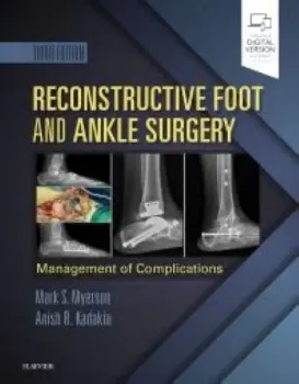 Imagem de Reconstructive Foot and Ankle Surgery: Management of Complications
