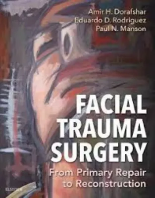 Imagem de Facial Trauma Surgery: From Primary Repair to Reconstruction