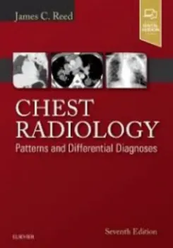 Picture of Book Chest Radiology