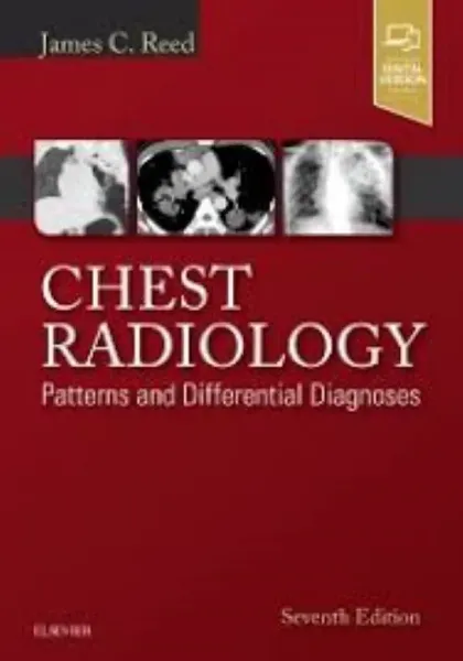 Imagem de Chest Radiology