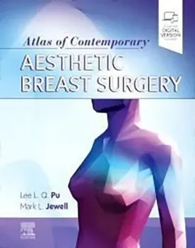 Picture of Book Atlas of Contemporary Aesthetic Breast Surgery: A Comprehensive Approach