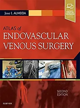 Imagem de Atlas of Endovascular Venous Surgery