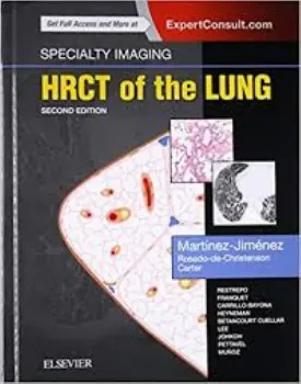 Picture of Book Specialty Imaging: HRCT of the Lung
