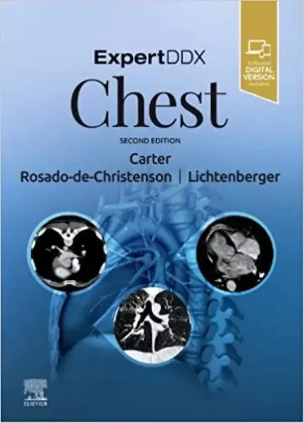 Imagem de Expert DDX Chest