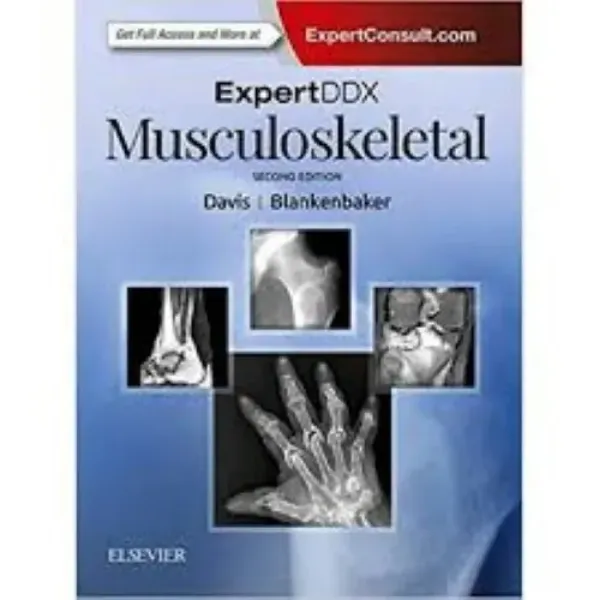 Imagem de Expert DDX Musculoskeletal