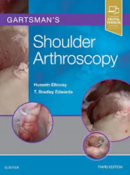 Imagem de Gartsman's Shoulder Arthroscopy