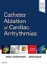Imagem de Catheter Ablation of Cardiac Arrhythmias