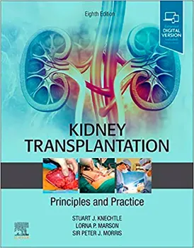 Imagem de Kidney Transplantation - Principles and Practice
