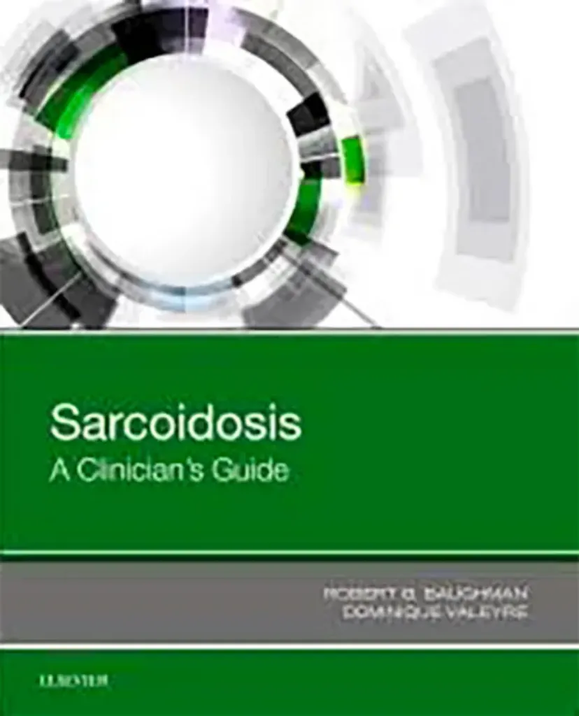 Imagem de Sarcoidosis