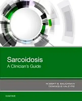 Picture of Book Sarcoidosis