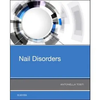 Imagem de Nail Disorders