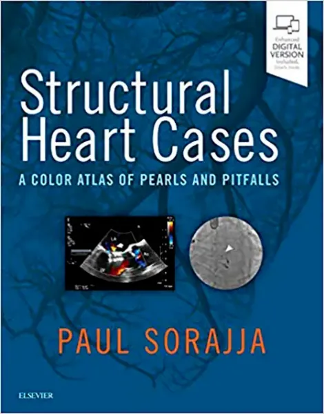 Imagem de Structural Heart Cases