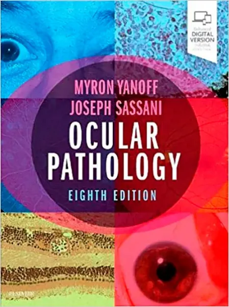 Imagem de Ocular Pathology