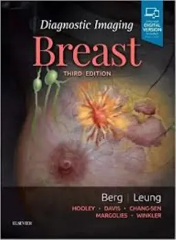 Picture of Book Diagnostic Imaging: Breast