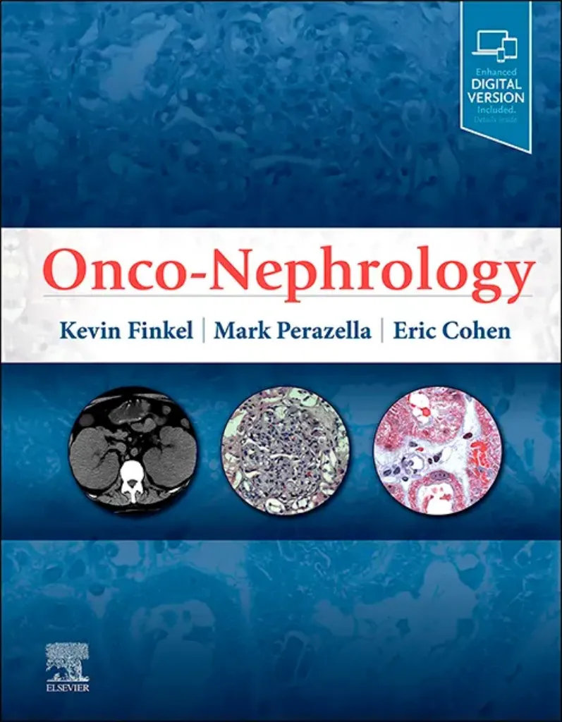 Imagem de Onco-Nephrology