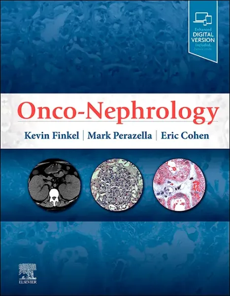 Imagem de Onco-Nephrology