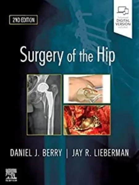 Imagem de Surgery of the Hip
