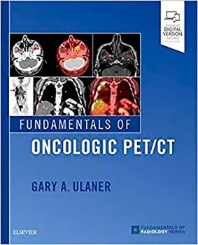Picture of Book Fundamentals of Oncologic PET/CT