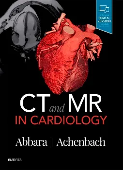 Imagem de CT and MR in Cardiology