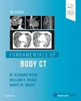 Imagem de Fundamentals of Body CT
