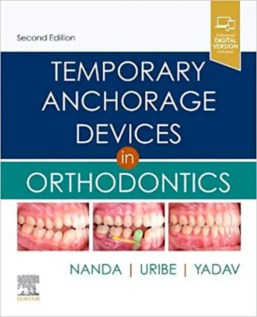Imagem de Temporary Anchorage Devices in Orthodontics