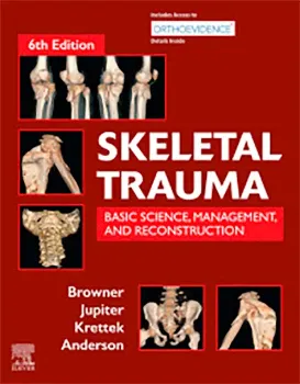 Imagem de Skeletal Trauma: Basic Science, Management, and Reconstruction 2 Vol. Set
