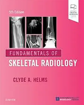 Imagem de Fundamentals of Skeletal Radiology