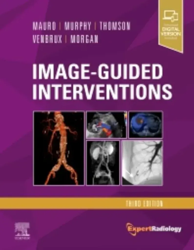 Imagem de Image-Guided Interventions