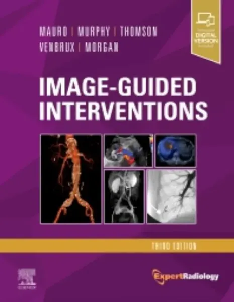 Imagem de Image-Guided Interventions