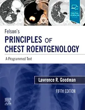Picture of Book Felson's Principles of Chest Roentgenology