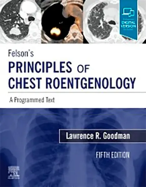 Imagem de Felson's Principles of Chest Roentgenology