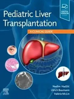 Picture of Book Pediatric Liver Transplantation: A Clinical Guide