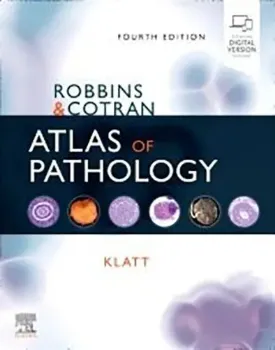Imagem de Robbins and Cotran Atlas of Pathology