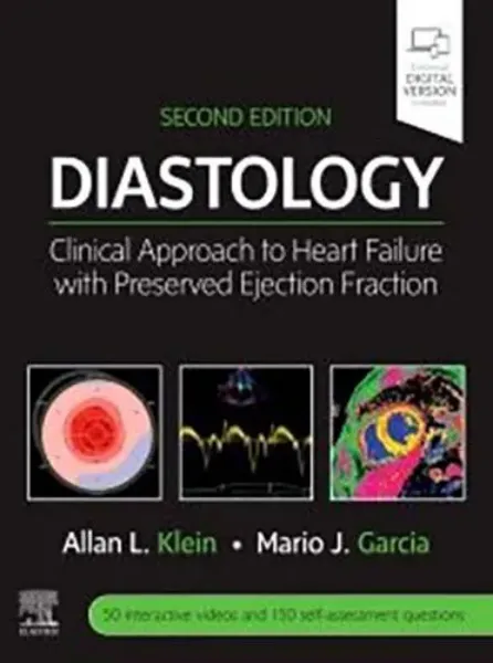 Imagem de Diastology: Clinical Approach to Heart Failure with Preserved Ejection Fraction