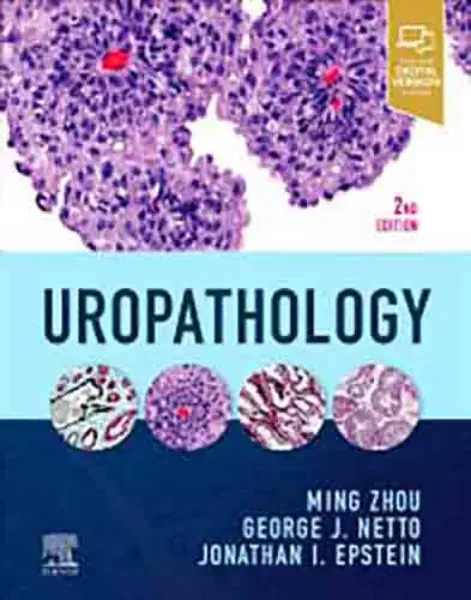 Imagem de Uropathology