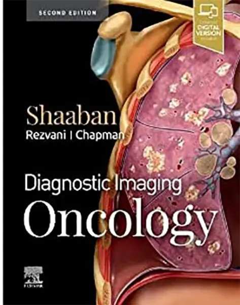 Imagem de Diagnostic Imaging: Oncology
