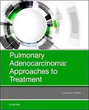 Imagem de Pulmonary Adenocarcinoma: Approaches to Treatment