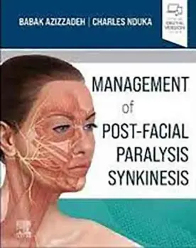 Imagem de Management of Post-Facial Paralysis Synkinesis