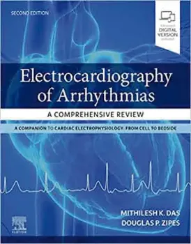 Picture of Book Electrocardiography of Arrhythmias: A Comprehensive Review - A Companion to Cardiac Electrophysiology