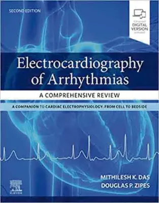Imagem de Electrocardiography of Arrhythmias: A Comprehensive Review - A Companion to Cardiac Electrophysiology