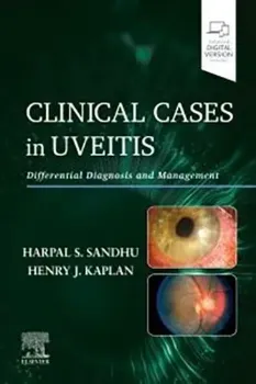 Imagem de Clinical Cases in Uveitis: Differential Diagnosis and Management