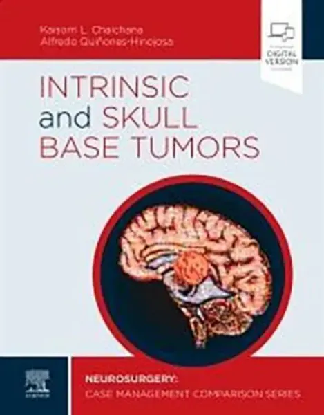 Imagem de Intrinsic and Skull Base Tumors