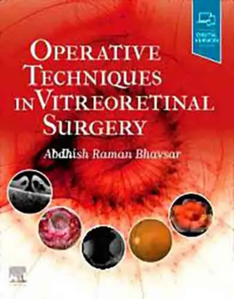 Imagem de Operative Techniques in Vitreoretinal Surgery